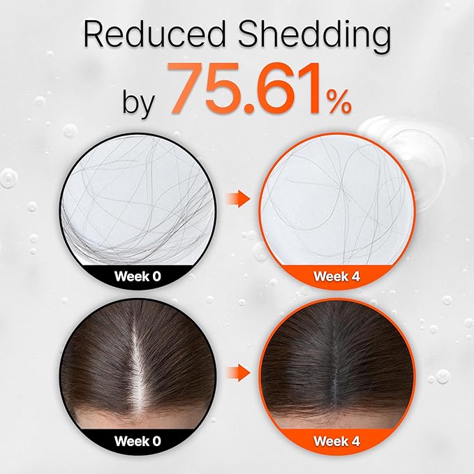 lilyeve GROWTURN Hair Growth Serum with Built-in Brush, Heartleaf-Derived Exosomes to Revitalize & Thickening Hair, Hair Growth Accelerator - Korean Hair Care, 1.01 fl. oz. (Pack of 2)