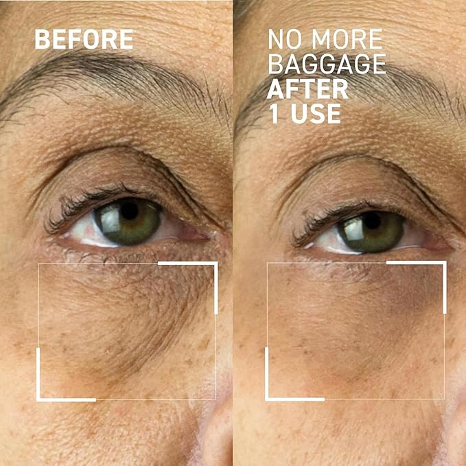 Dr. Brandt Needles No More, No More Baggage Bundle - Minimizes Under-Eye Bags, Puffiness & Dark Circles - Full (0.5 oz) + Travel Size (0.25 oz)