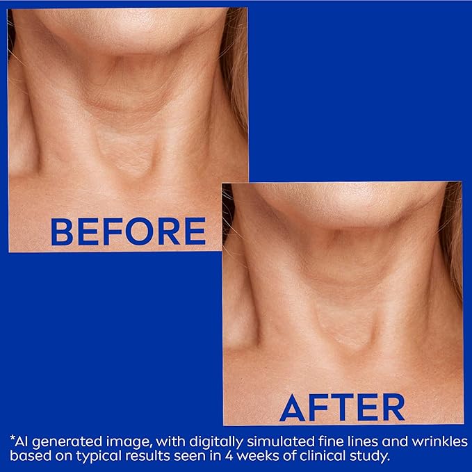 NIVEA Skin Firming & Anti Wrinkle Neck & Chest Cream with Coenzyme Q10, Creatine and Provitamin B5, Skin Firming Cream Reduces the Look of Fine Lines and Wrinkles, 6.7 Oz Tube
