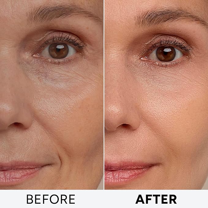 Retinol Cream for Face with Collagen Peptides - Anti Aging Wrinkle Cream for Women and Men - Day-Night Facial Moisturizer with Hyaluronic Acid - Tightening and Skin Firming - Neck & Décolleté