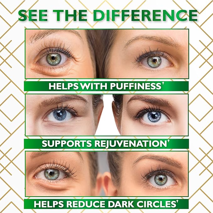 Under Eye Mask for Puffy Eyes, Dark Circles, Eye Bags, Puffiness, Wrinkles with Collagen - Hydrating - Green Tea Skincare - Anti-Aging Eye Patch Treatment Masks - 60 Under Eye Gel Pads