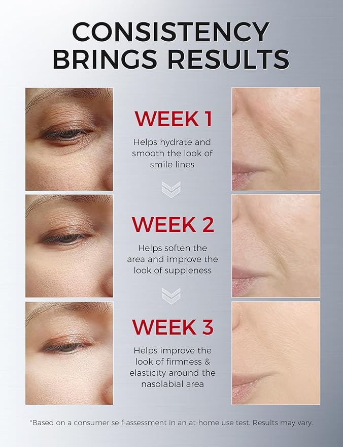 NING DERMOLOGIE Smile Line & Under Eye Patches – 4-Peptide Anti-Wrinkle Treatment with Collagen, Caffeine & Niacinamide – Firming, Hydrating, Brightening Face Pads for Laugh Lines, Eye Bags, 10 Pairs