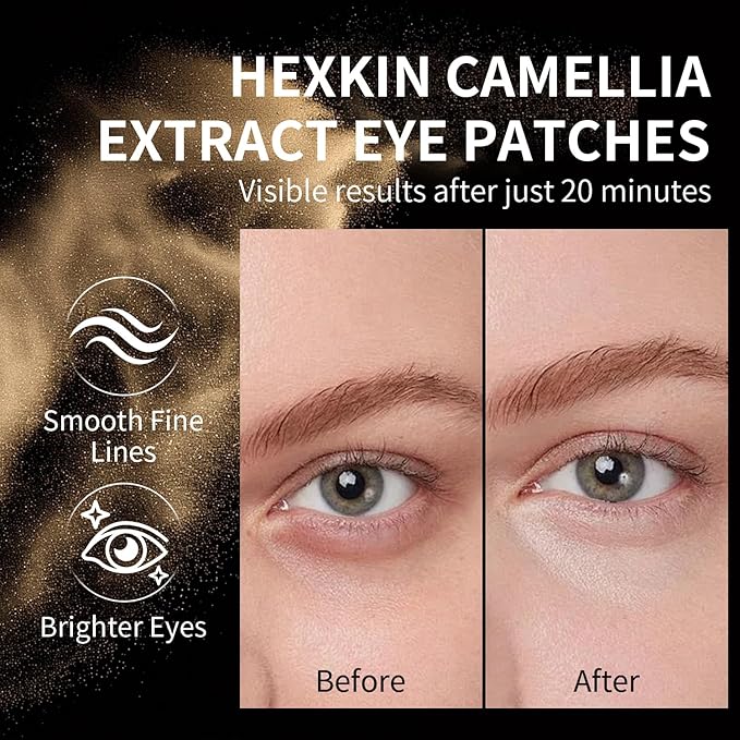 Eye Patches for Puffy Eyes and Dark Circles – Firming Collagen Eye Mask for Women, Under Eye Serum with Centella & Glutathione, Korean Skincare, U-Shape Design, 10 Pairs