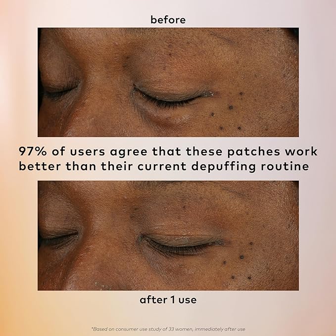 The Good Patch Brighten Up Hydrogel Under Eye Patches for Dark Circles and Puffy Eyes, Made with Niacinamide, Vitamin K, Pine Leaf Extract, Clinically Proven (18 Total Patch Sets)