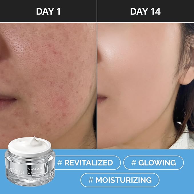 Retinol Night Cream 1.69oz - No.1 Korean Premium Overnight Repair Cream for Face and Neck - Collagen, Centella, Hyaluronic Acid - Anti aging, Acne, Moisturizer, Face Cream, Hydrating, Firming