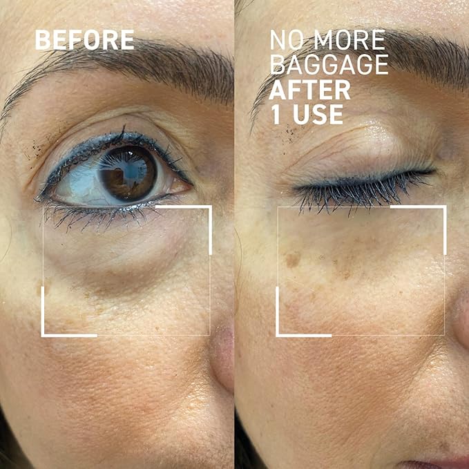Dr. Brandt Needles No More, No More Baggage - 1 oz (Jumbo Size) - Minimizes Under-Eye Bags, Puffiness & Dark Circles