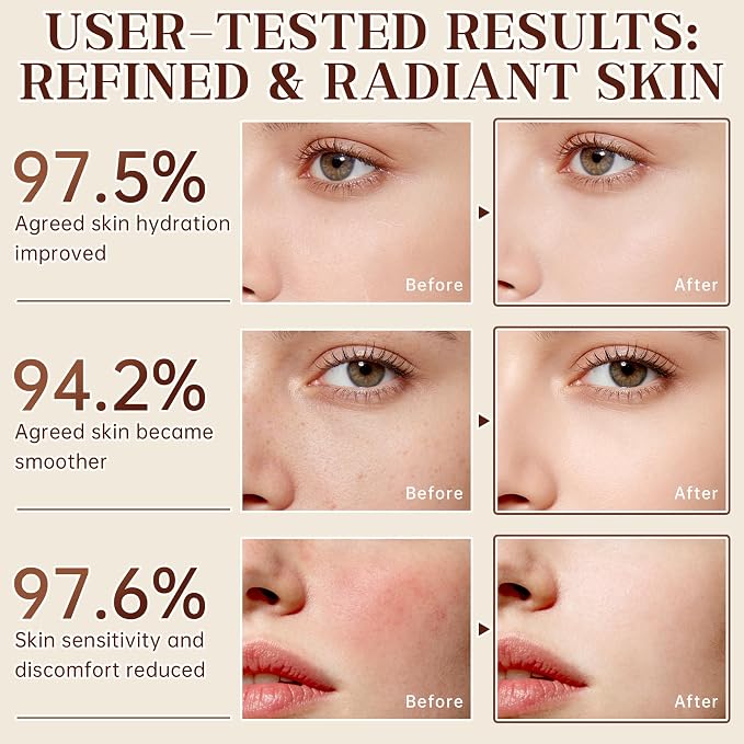 7PCS Rice Skincare Set Gift Box, Korean Skin Care Set for Women Teens Girls, Rice Cleanser Toner Serum Face Cream Eye Cream Sunscreen with Towel Bear Ornament, Hydrating Daily Face Care Kit