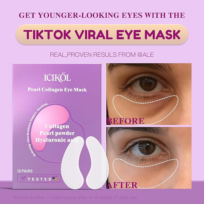 Hyaluronic Acid Collagen Under Eye Patches, Eye Mask for Puffy Eyes and Dark Circles, Deep Hydrating Eye Mask Patches for Eye Bags Treatment, Under-eye Skincare for All-day Moisture (12 pairs)