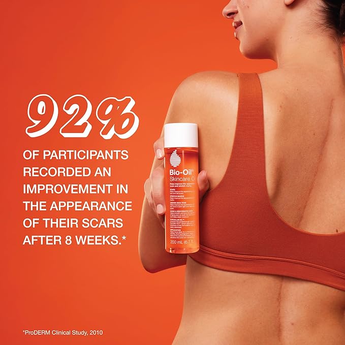 Bio-Oil Skincare Body Oil Serum for Scars and Stretch Marks, Face and Body Moisturizer with Vitamin E & A for Sensitive Dry Skin, Dermatologist Recommended, Non-Comedogenic, 4.2 Oz