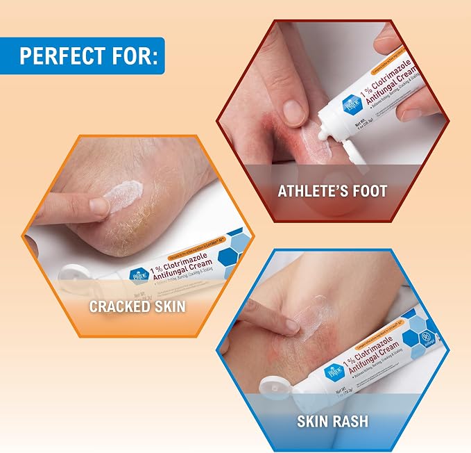 MED PRIDE Clotrimazole 1% Antifungal Cream, Itch Relief Treatment, 1 oz