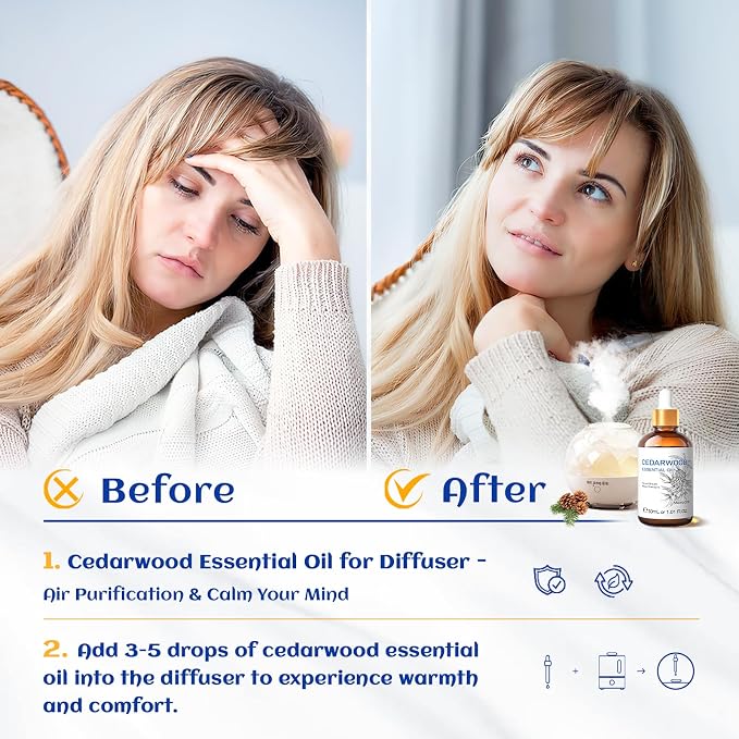 HIQILI 1 Fl Oz Cedarwood Essential Oil, Cedarwood Oil for Hair, Diffuser, Aromatherapy - 30ML | For Massage Skin Care Soap Bath Bombs Lotions Boost Scalp Circulation Reduce Hair Loss Fade Acne Marks - 30mL / 1.01 fl.oz