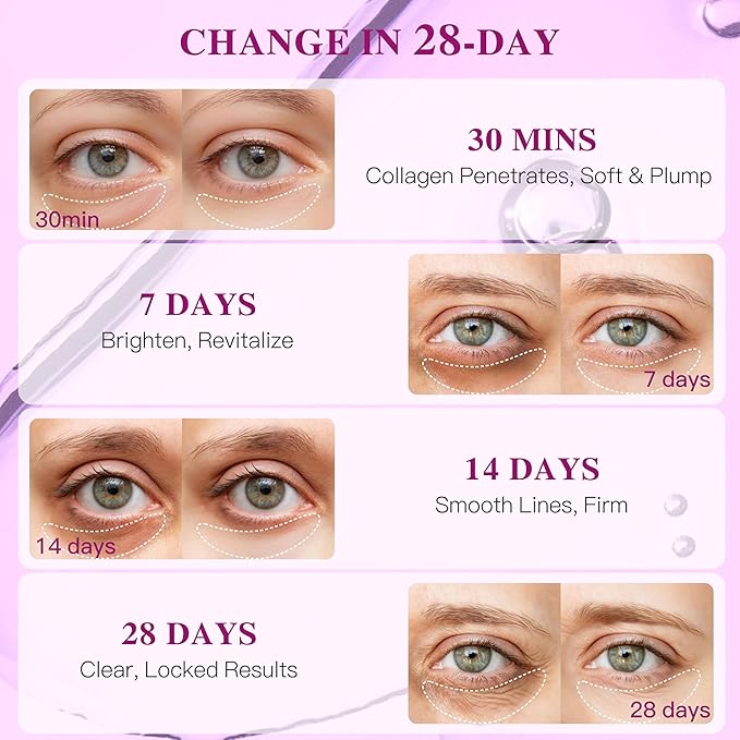 Hyaluronic Acid Collagen Under Eye Patches, Eye Mask for Puffy Eyes and Dark Circles, Deep Hydrating Eye Mask Patches for Eye Bags Treatment, Under-eye Skincare for All-day Moisture (24 pairs)