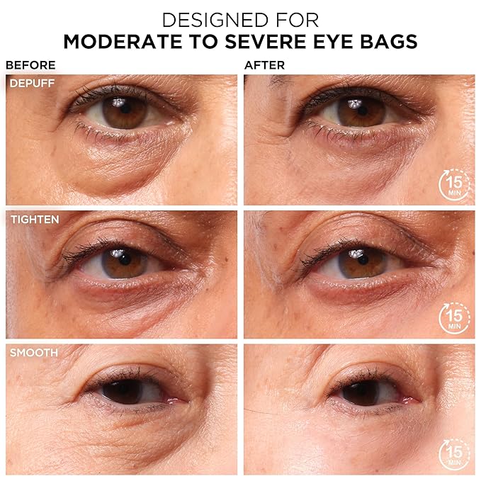 IT Cosmetics Bye Bye Under Eye Bags Daytime Treatment - Temporary Eye Bag Reducer & Undereye Corrector, Smooths & Reduces Look of Wrinkles & Fine Lines, Transparent Finish - 0.5 oz (2-pack)