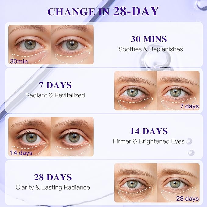 Grape Seed Collagen Under Eye Patches, Eye Mask for Puffy Eyes and Dark Circles, Deep Hydrating Under Eye Mask Patches for Eye Bags Treatment, Under-eye Skincare Boost Radiance (12 pairs)