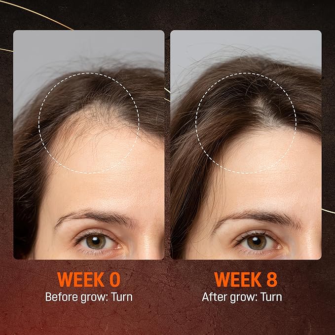 Abera Hair Growth Serum for Hair Loss, Natural Hair Regrowth Treatment for Hair & Beard with Biotin & Castor Oil | Extra Strength & Bigger Size 1.69 fl oz
