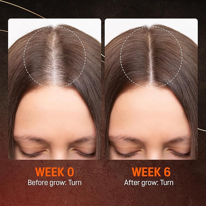 Abera Hair Growth Serum for Hair Loss, Natural Hair Regrowth Treatment for Hair & Beard with Biotin & Castor Oil | Extra Strength & Bigger Size 1.69 fl oz (1 Serum + Gift)